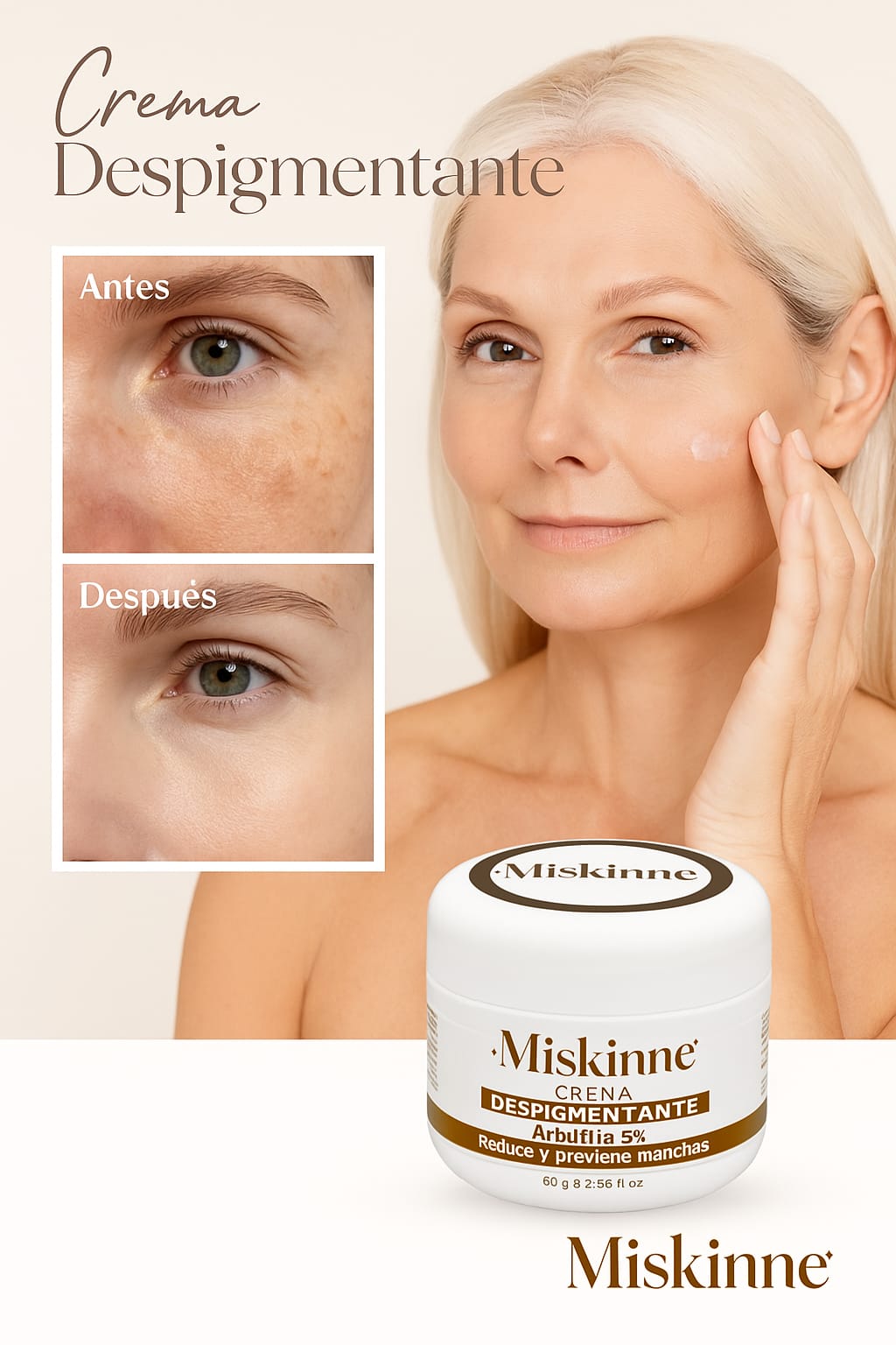 Crema Despigmentante Miskinne